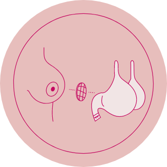 Icon of a pad being positioned inside of a bra.